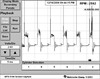 1995 Chevrolet Blazer, Ignition waveform