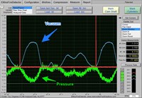 2002 Jeep Liberty Limited, Engine/Propulsion Waveform