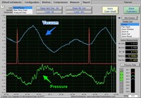 2002 Jeep Liberty Limited, Engine/Propulsion Waveform